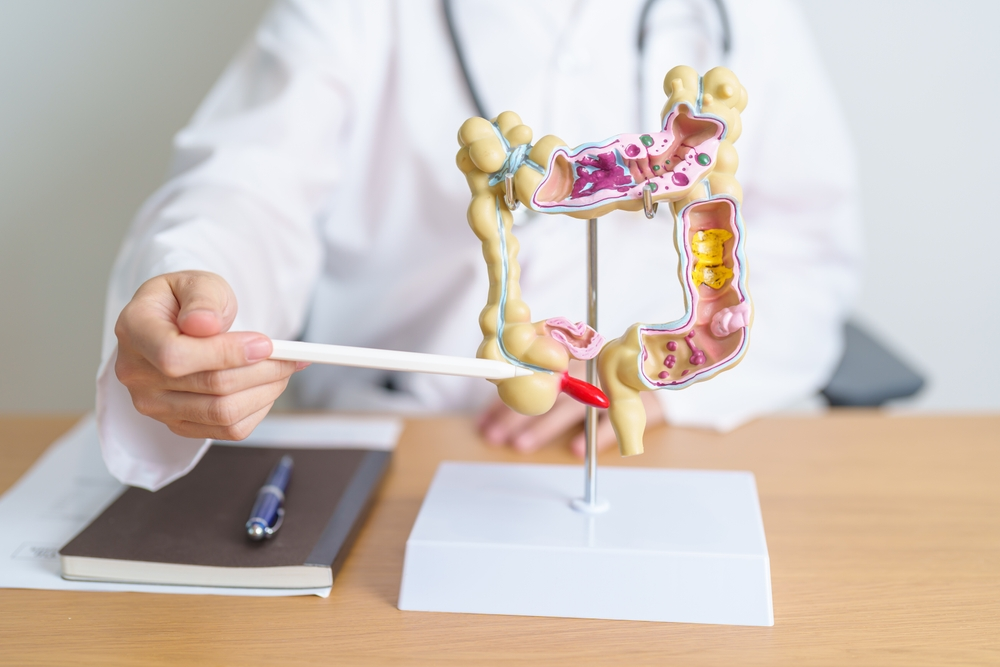 doctor pointing at model of bowels