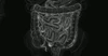 Wahls-Healing Leaky Gut Naturally-Sept26